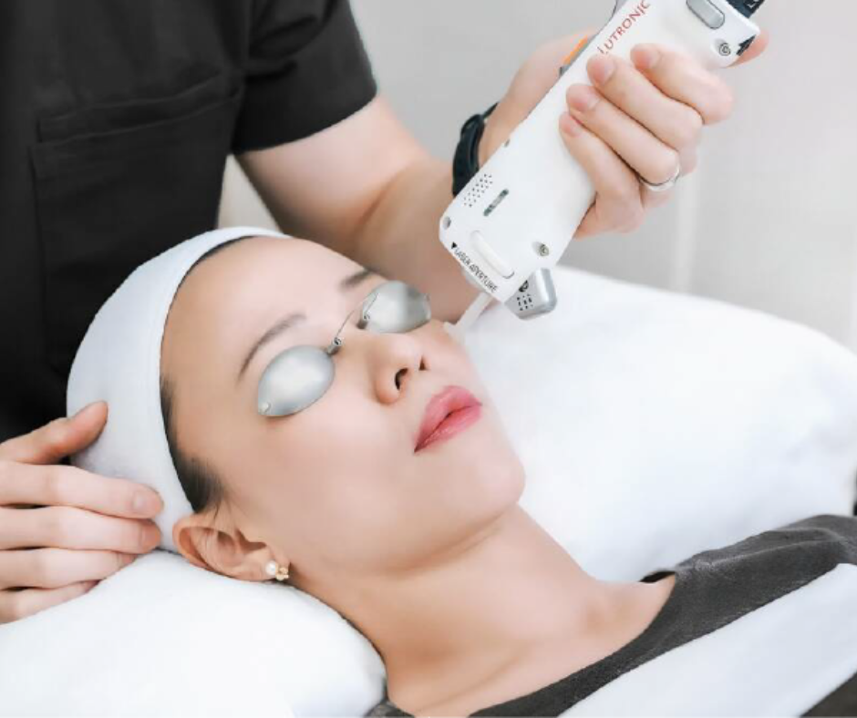 a lady getting a lutronic clarity II skin toning treatment while wearing sun tan goggles